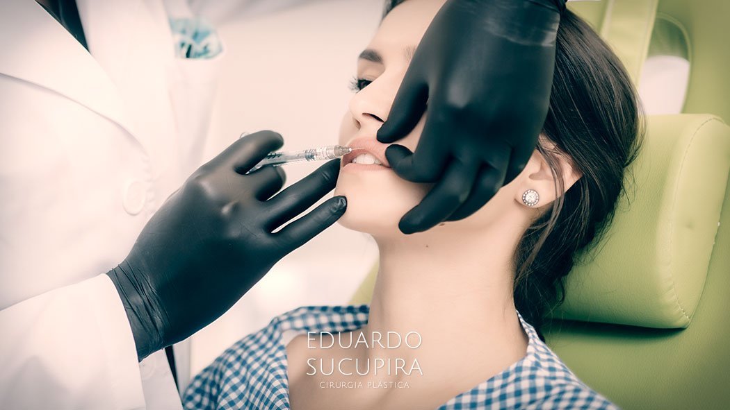 Como é feito o Preenchimento Labial?