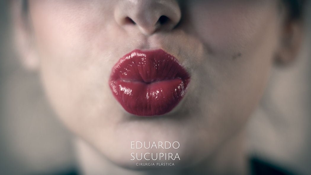 Por Quanto Tempo Dura os Resultados do Preenchimento Labial?