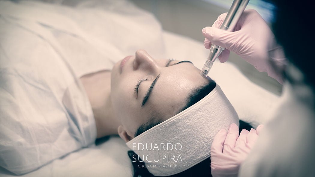 Combinação de Botox com Outros Procedimentos Minimamente Invasivos